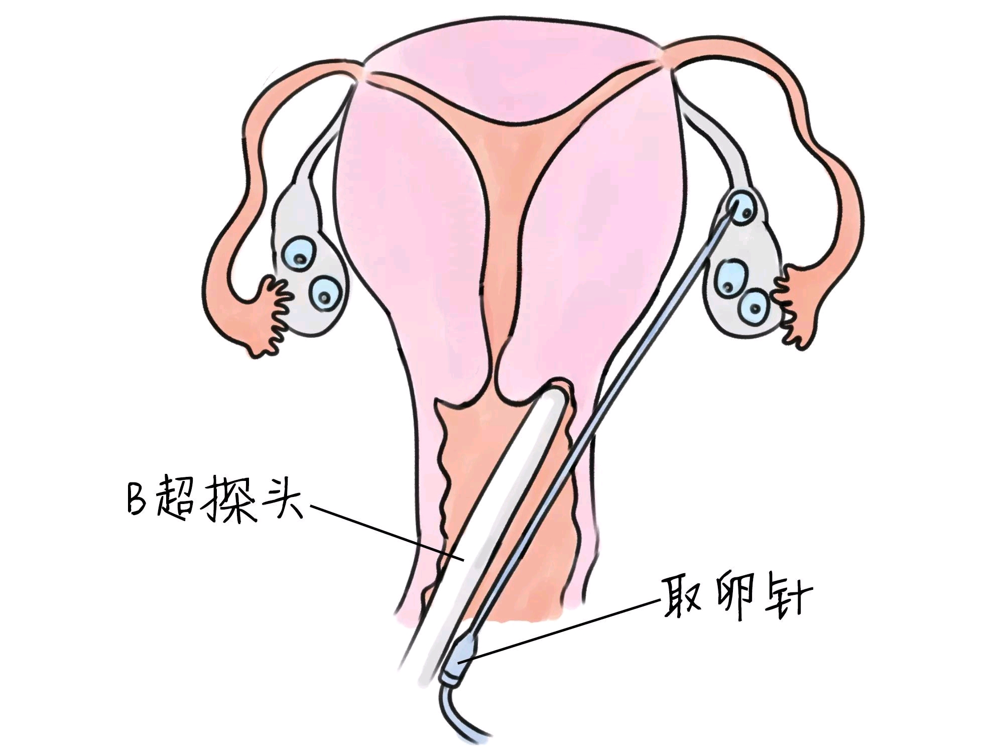刚怀孕能吃螃蟹吗