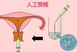 怀孕