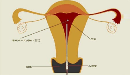 婴儿