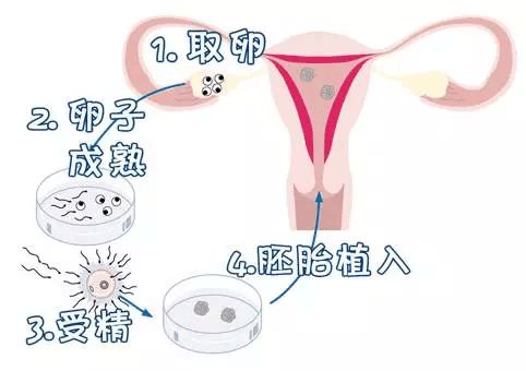 初期孕检