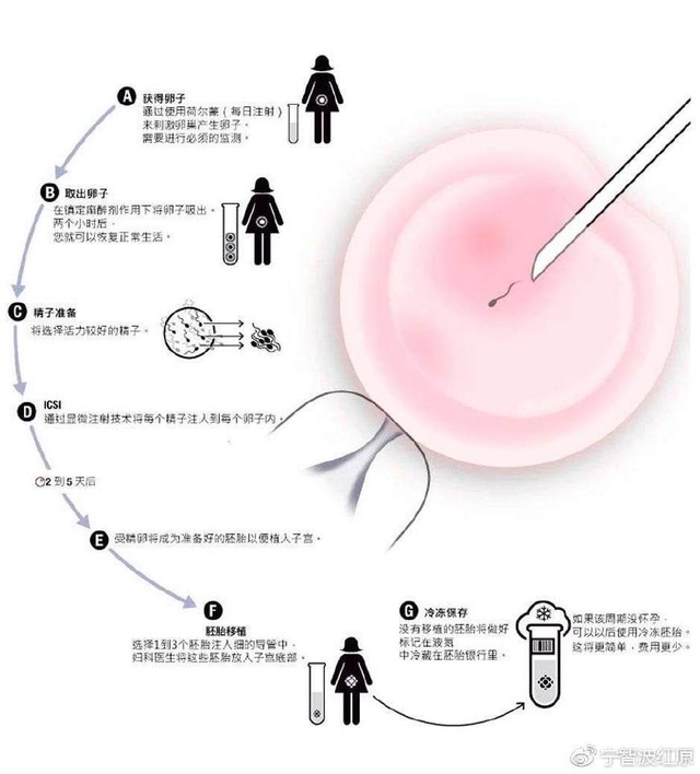 孕妇