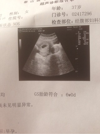 孕妇奶粉