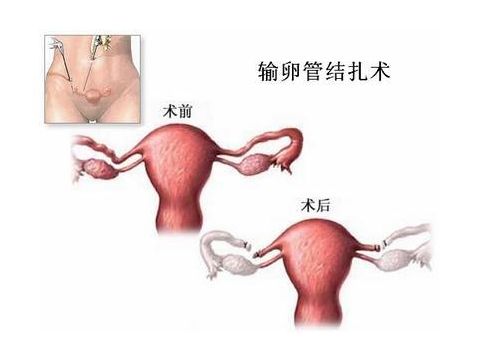 怀孕初期