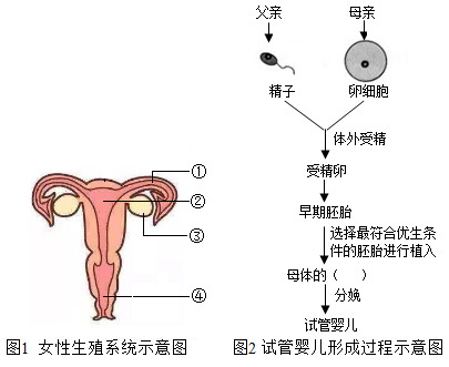 人流手术