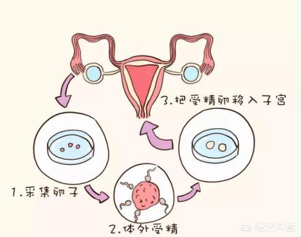 药物流产