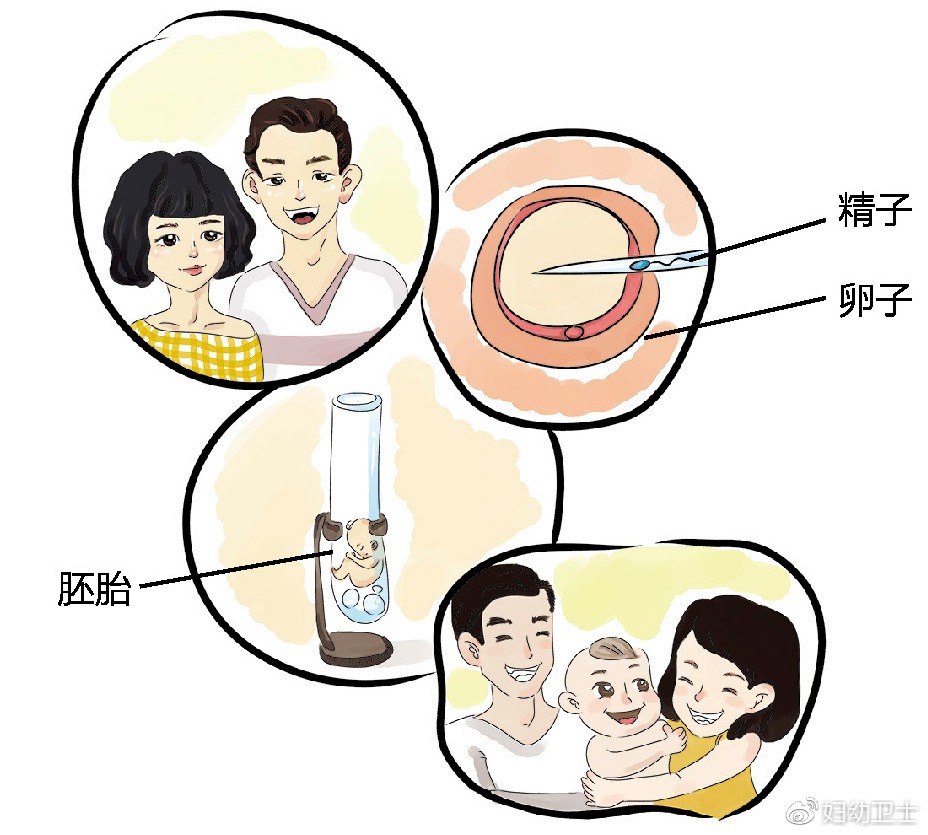 剖腹产产后下奶