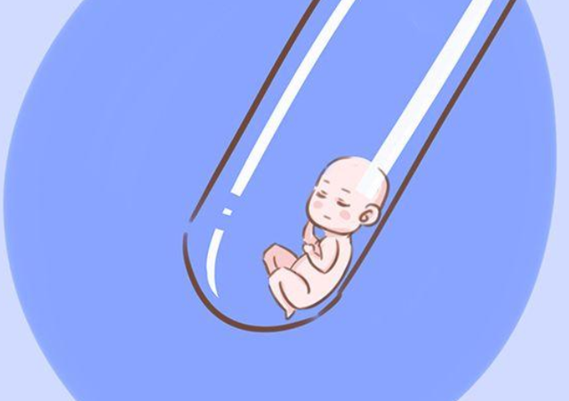 剖腹产手术