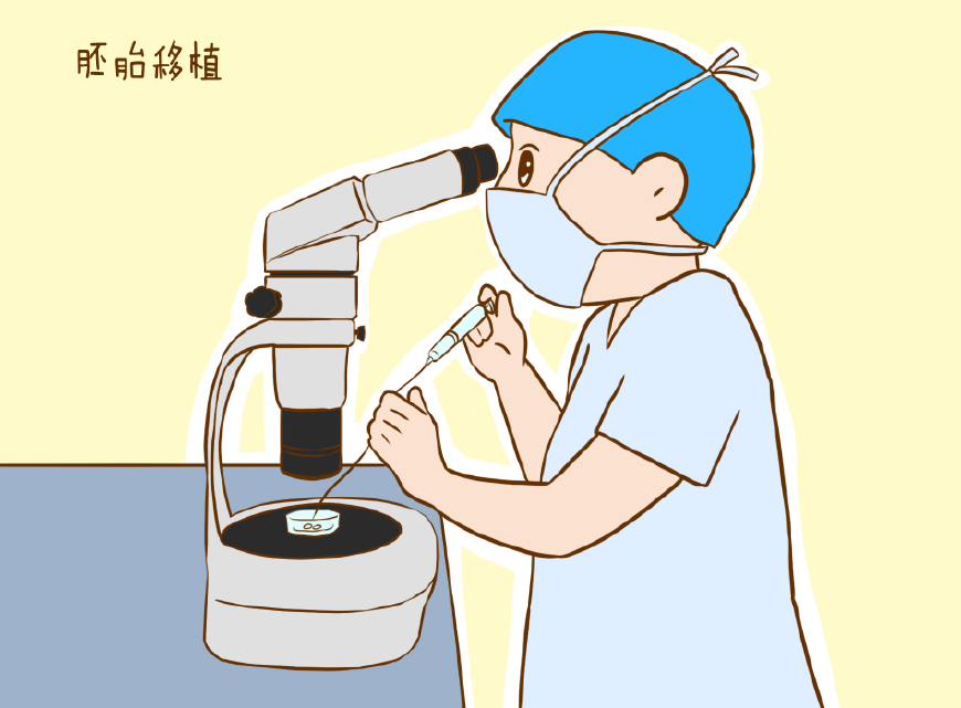 剖腹产