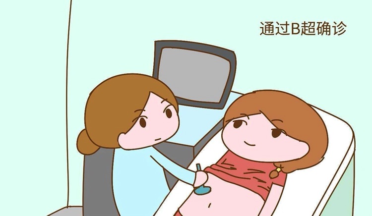 怀孕检查