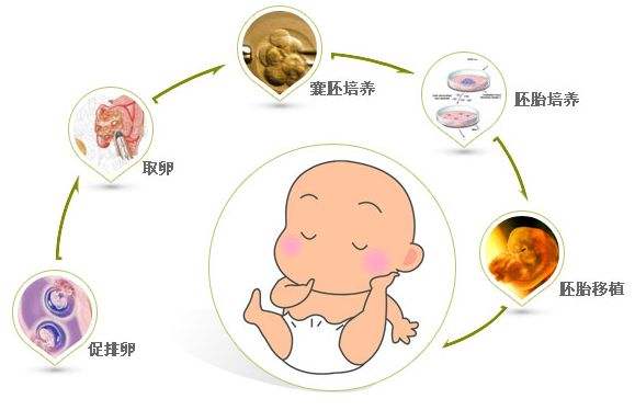 人流手术