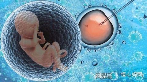 剧烈宫缩阵痛
