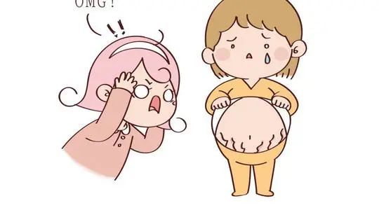 剖腹产