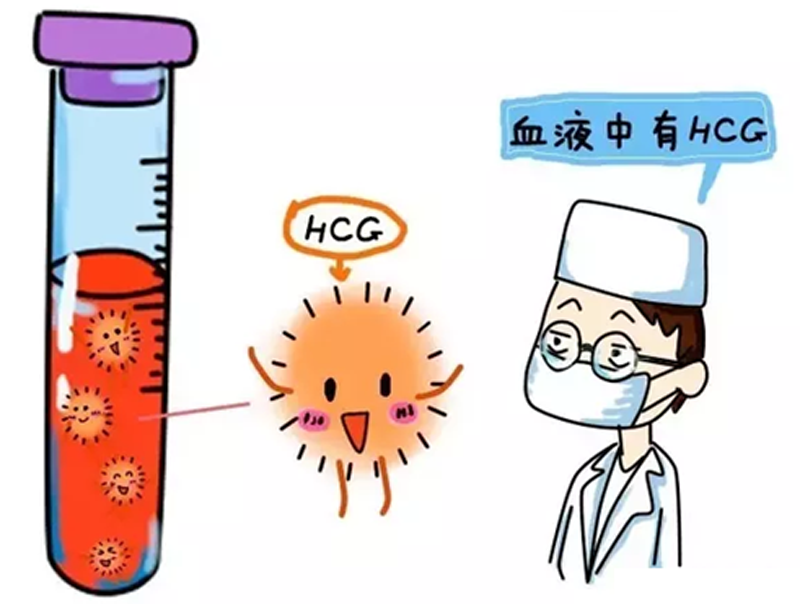 劳动仲裁