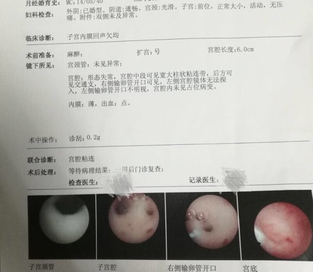 初生儿喝母乳拉稀