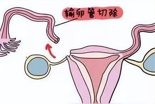 婴儿保温箱