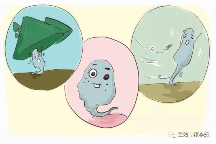 剖腹产