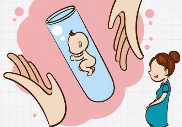 剖腹产
