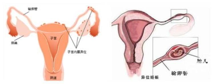 国内捐卵公司